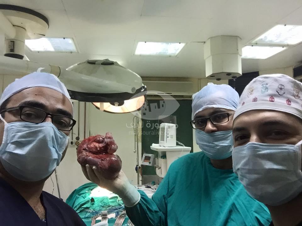 فريق جراحى بمستشفى الأطفال بجامعة المنصورة يستأصل ورم نادر من بطن طفل